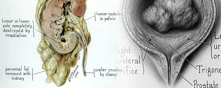 Medical Illustrations