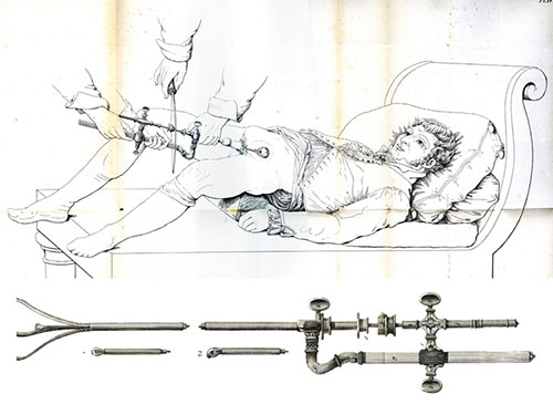 Lithotriptor