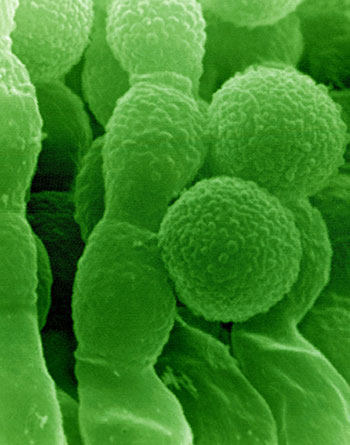 SEM Penicillium mould producing spores, v. close-up.